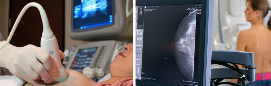 Акция «Цифровая маммография»